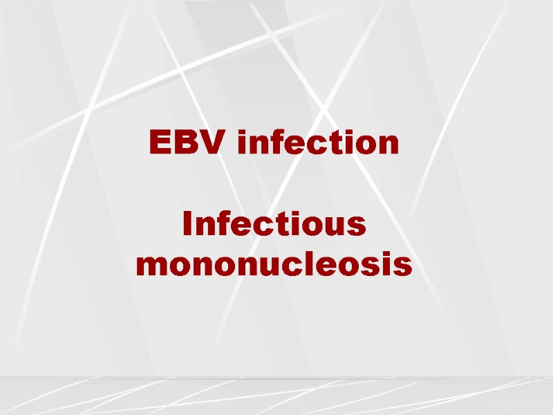 EВV infection  Infectious mononucleosis
